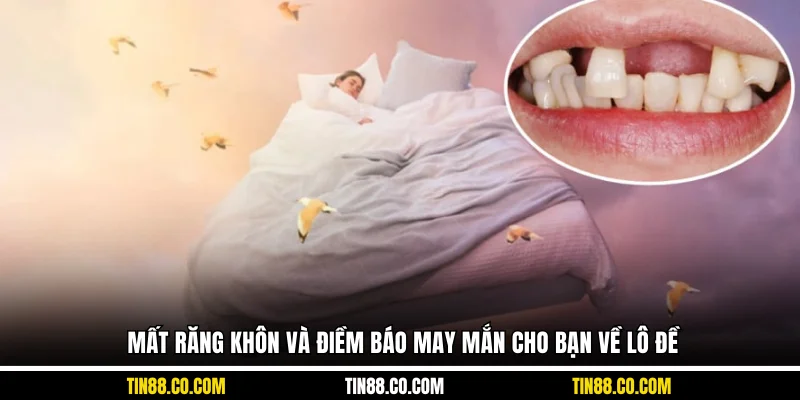 Mất răng khôn và điềm báo may mắn cho bạn về lô đề