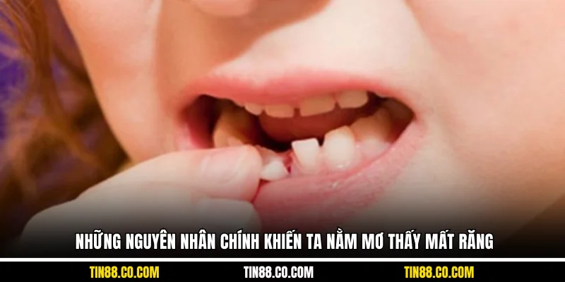 Những nguyên nhân chính khiến ta nằm mơ thấy mất răng